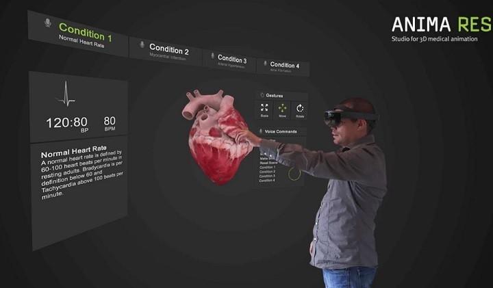 Aplikacja INSIGHT HEART HoloLens